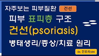 건선psoriasis 어떤 질환인가 병태생리증상분류치료 원리를 이해해봅시다 [upl. by Vinay]