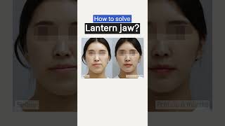 EN Lantern jaw How to solve the lantern jaw [upl. by Swor893]