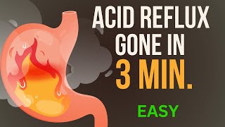 How to Get Rid of Acid Reflux PERMANENTLY with Betaine hydrochloride  Treat Acid Reflux Naturally [upl. by Millda]