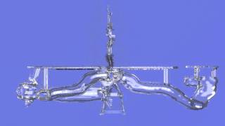 Gonadal Vein Embolization Extension Model [upl. by Fortunato]