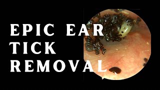 EPIC EAR TICK REMOVAL MUST WATCH VIDEO BEFORE YOU DIE 4K 60fps [upl. by Yedorb]