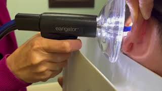 Ear Wax Removal with the Earrigator [upl. by Leeland]