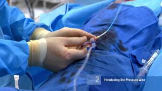 FFR Basics Performing an FFR Procedure  Mort Kern MD [upl. by Frants]