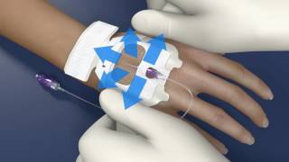 Tegaderm™ IV Advanced Dressing 1683 for PIV Application Video [upl. by Osi]