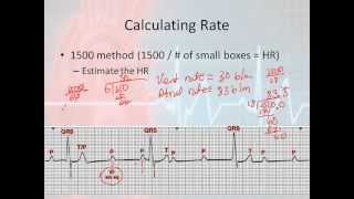 Basic Rhythm Interpretation part 5  The Systematic Approach 2 [upl. by Ramel]