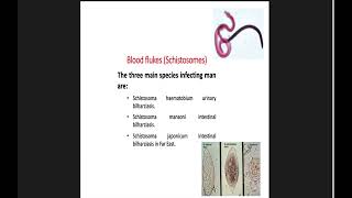 Parasitology  Schistosoma haematobium  by Dr Shimaa Nephrology Module [upl. by Enrobso846]