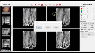 HANDYDENTIST  STEP 7 ADJUSTING IMAGES  WWW3NITYSUPPLYCOM [upl. by Kuska392]