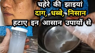 चहेरे की झाइयां दाग धब्बे हटाए इन आसान उपायों से  How to Remove Melasma at home [upl. by Houser66]