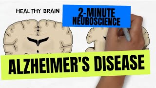 2Minute Neuroscience Alzheimers Disease [upl. by Campball279]