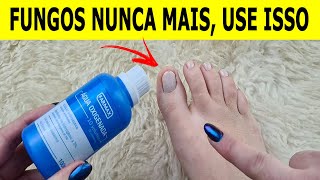 NUNCA MAIS TIVE FUNGOS E MICOSE NAS UNHAS DEPOIS QUE VI ESSA RECEITA [upl. by Ihpen880]