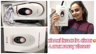 XIAOMİ INFACE IPL CİHAZI 4 AYLIK SONUÇ VİDEOSU 🎉 [upl. by Ybbil]