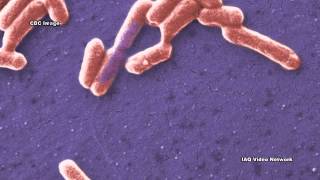 CarbapenemResistant Enterobacteriaceae CRE [upl. by Jevon]