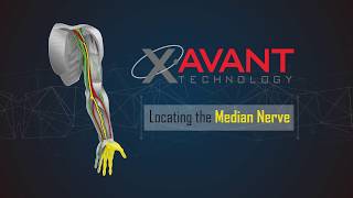 Locating and Treating the Median Nerve  Neural Surface Anatomy Series  Stimpod NMS460 [upl. by Koren728]