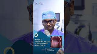 Liver Metastasis in Stage 4 Cancer Key Differences and What They Mean  Dr Praveen Kammar [upl. by Joya175]