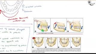 Condyle fracture Oral surgery [upl. by Acirdna]