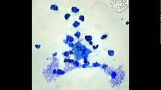 Physarum polycephalum gets the blues in time lapse [upl. by Atsiuqal]