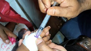 Child Meropenem 250mg amp Amikacin intravenous injection Video 24 Ep 71 Injection Tips [upl. by Nadnal]