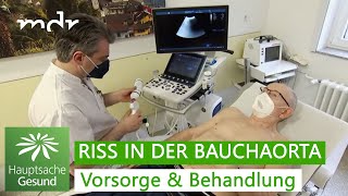 BauchaortenAneurysma Tickende Zeitbombe  Hauptsache gesund  MDR [upl. by Oiramd]