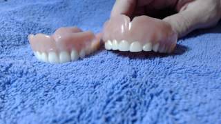 Temporary VS Permanent denture [upl. by Ayifa]