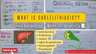 Cholelithiasis  Gall Bladder Stones  Surgery Hindi Lecture  Types amp Treatment With NOTES 🚨 [upl. by Nytsua627]