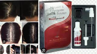 Kazegrow F Topical Solution Minoxidil amp Finasteride Jopical Solution [upl. by Relyuhcs]