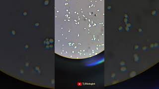 Negative staining  capsulated organism  Microbiology  Chennai clinical microbiologyTj Biologist [upl. by Ahcropal]