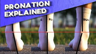 What is overpronation  Pronation types explained [upl. by Ykcaj745]