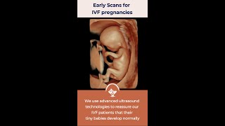 Early scans specially designed for IVF pregnancies [upl. by Lain]