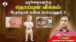 குழந்தைகளுக்கு தொப்புள் வீக்கம் இருந்தால் என்ன செய்யணும்   Dr Saguls Paediatric corner [upl. by Rukna]