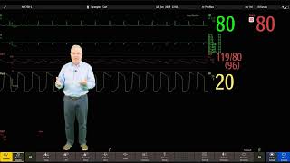 Philips IntelliVue Patient Monitoring  3  Main Screen Display [upl. by Elsilrac]