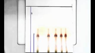 10 Thin layer chromatography  TLC [upl. by Remmer409]