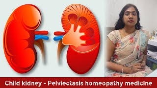 Child kidney  Pelviectasis homeopathy medicine [upl. by Nomyar]