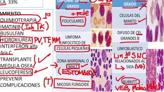 Linfomas [upl. by Albert]