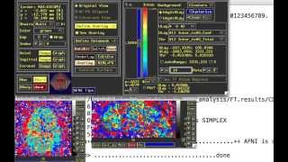 PsychoPhysiological Interactions or PPI aka ContextDependent Correlations [upl. by Ferde540]