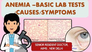 ANEMIA BASIC LAB TESTS  ANIMATED VIDEO [upl. by Dalenna]