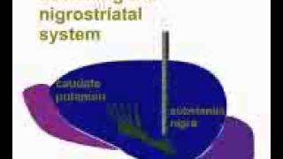 Nigrostriatal lesions provide an animal model of Parkinsons disease [upl. by Nichola]