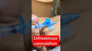 Intravenous iv Cannulation  trending hospital cannula doctor SMpharmacy subscribe [upl. by Halas]