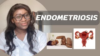 ENDOMETRIOSIS AND INFERTILITY  causes symptoms diagnosis and treatment of endometriosis [upl. by Mcgill]