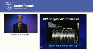 Knowledge Gaps Prosthetic Valve Thrombosis  Mayo Clinic CV Grand Rounds [upl. by Cooe536]