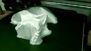 3D Printed Human Skull [upl. by Hawken662]