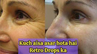 How to remove wrinkles  complete guide  Dr Harneet Kaur [upl. by Nivej732]