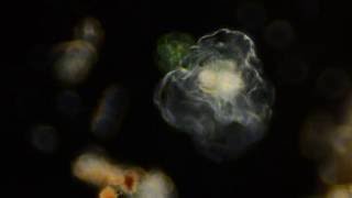 Amoeba video [upl. by Shanley272]