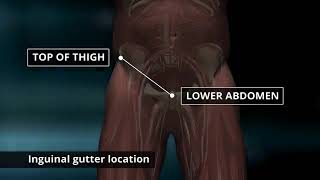 CMC 73 Assessing the Femoral Pulse [upl. by Hael]