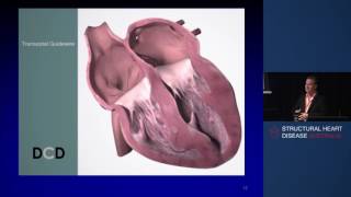 InterAtrial Shunt for Heart Failure with Preserved Ejection Fraction  Prof David Celermajer [upl. by Akinak967]