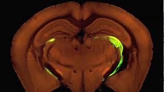 Whole Brain Images of Thy1 Cre Retinal Ganglion Cell Axons [upl. by Ahsieker]