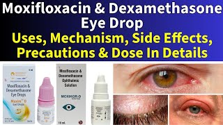 Moxifloxacin and Dexamethasone Eye DropsUses Dosage Action Side Effects amp Precautions In Details [upl. by Prestige]