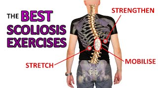 THE Best Exercises For Scoliosis [upl. by Nalo336]