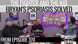 Chris DElia Solves How Bryan Got Psoriasis [upl. by Greenburg413]