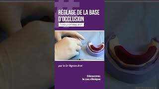 🦷 Tuto Prothèse 01  Le réglage de la base d’occlusion [upl. by Adnirod]