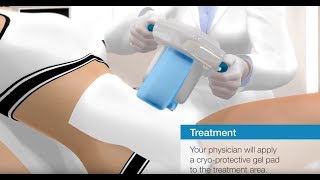 CRISTAL  Medical Cryolipolysis from France [upl. by Accever]